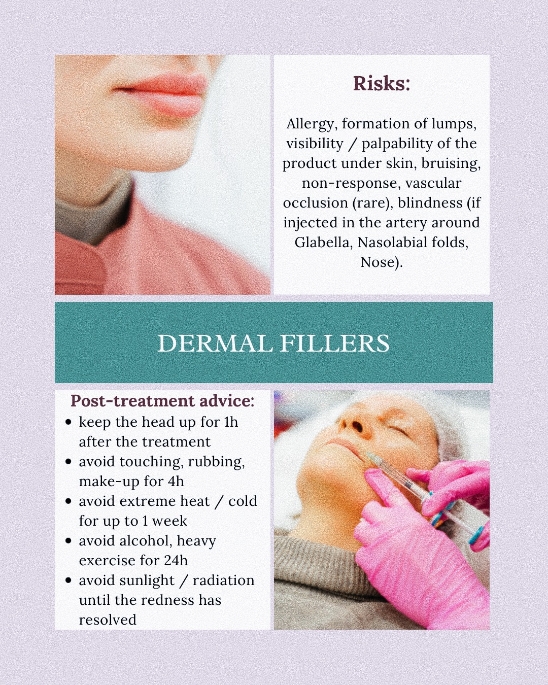 About Dermal Fillers.