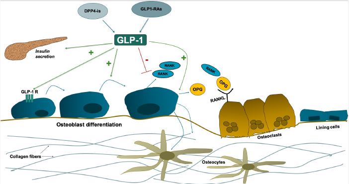Effect of Incretin Therapy on Bone Health In Type 2 Diabetes - a Systematic Review