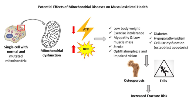 Skeletal Health in Patients with Mitochondrial Diabetes: Case Series and Review of Literature