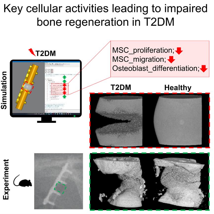 Reduced bone regeneration in type 2 diabetes mellitus as a result of impaired stromal cell and osteoblast function &ndash; a computer modeling study