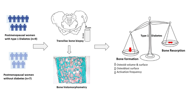 Bone Structure and Turnover in Postmenopausal Women with Long-Standing Type 1 Diabetes