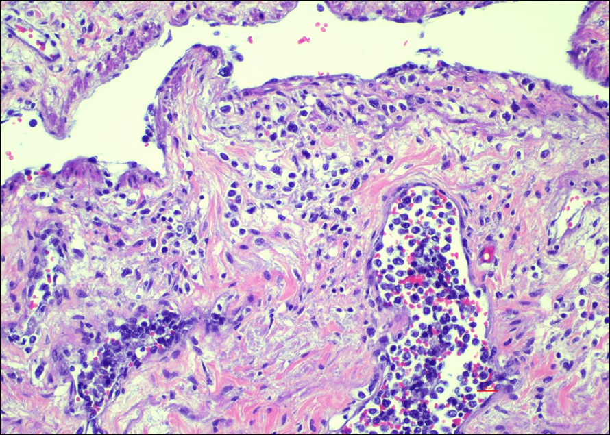Peri-testicular tissue, H&E 200x