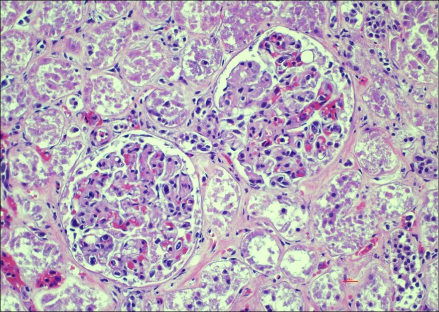 Glomeruli, H&E 200x