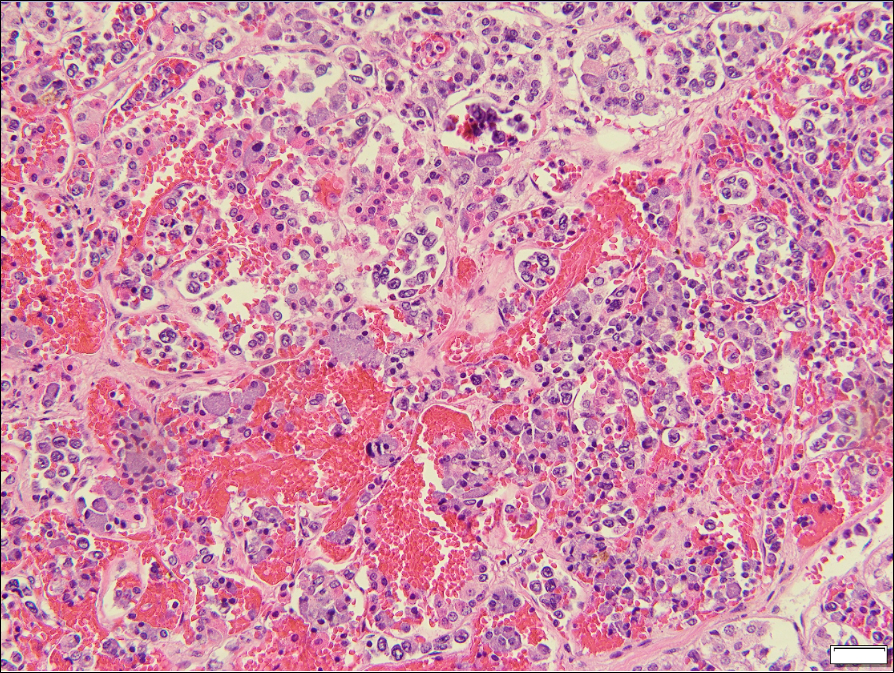 Pituitary gland, H&E 200x