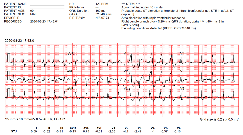 STEMI and 12 Lead ECG Recognition Exam Survey