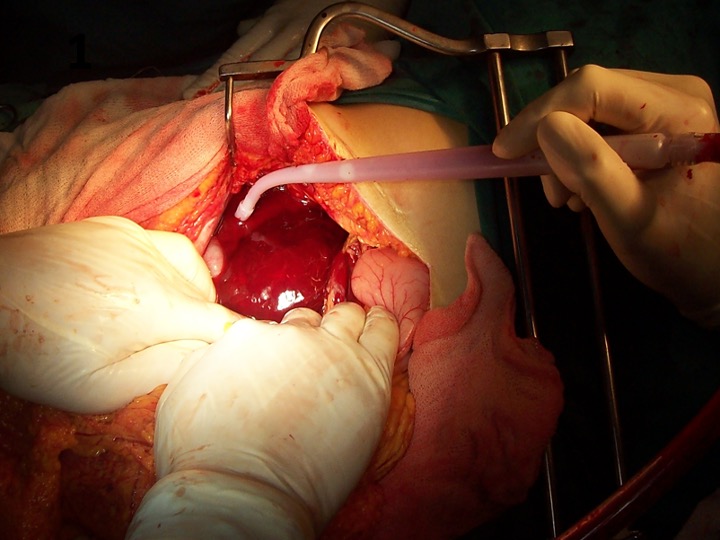 Observe la siguiente imagen