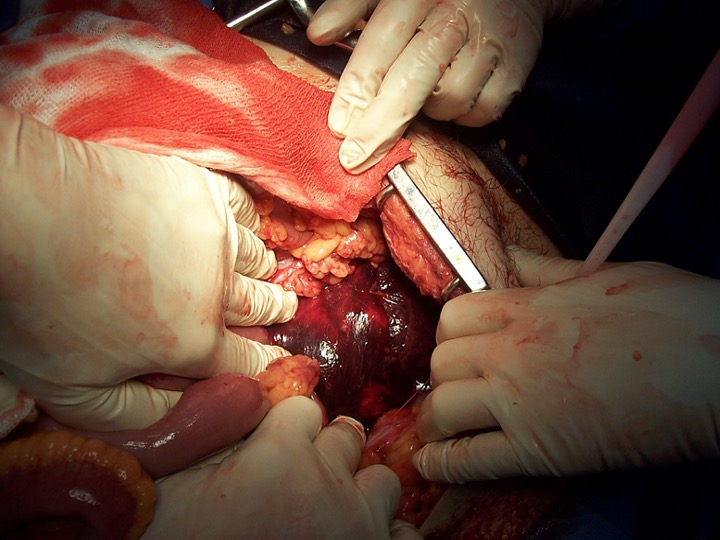 Observe la siguiente imagen