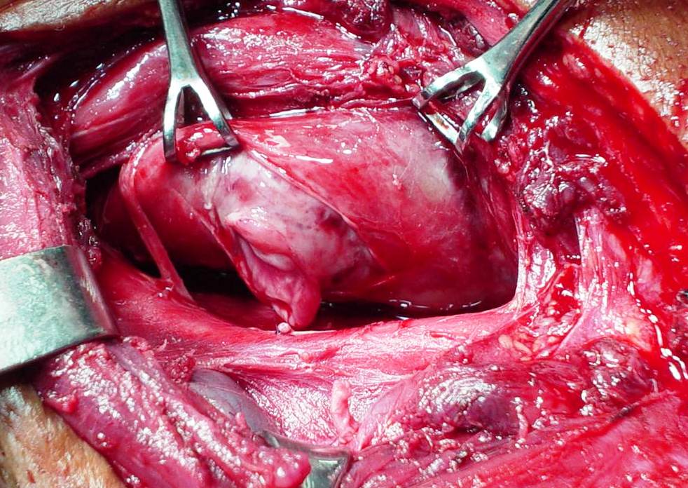 Observe la siguiente imagen (1)